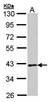 DMC1 antibody