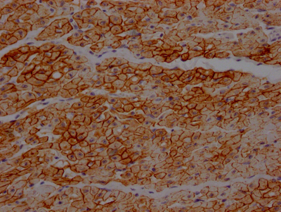 DMD antibody