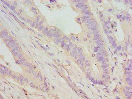 DMP1 Antibody