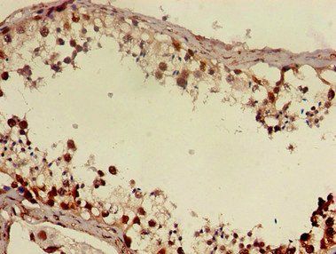 DMRT1 antibody