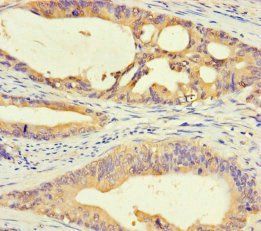 DMRTA1 Antibody