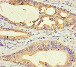 DMRTA1 antibody