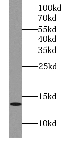 DMRTC1B antibody