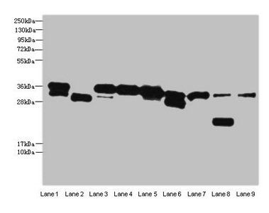 DNA-(apurinic or apyrimidinic site) lyase antibody