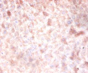 DNMT3A Antibody