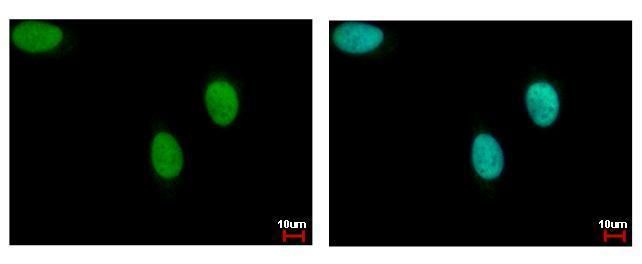 DNA ligase 3 Antibody