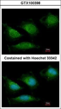 DNA polymerase gamma Rabbit Polyclonal Antibody