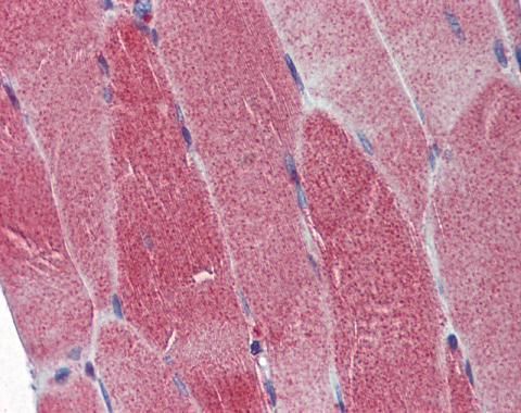 DNA polymerase gamma Rabbit Polyclonal Antibody