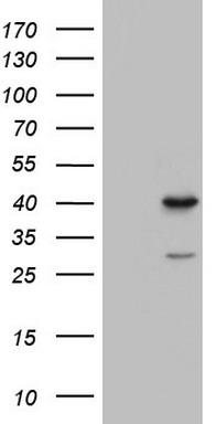 DNA Polymerase iota (POLI) antibody