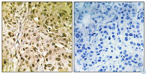 DNA Polymerase θ Antibody