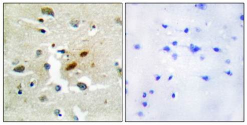 DNA Polymerase ζ Antibody