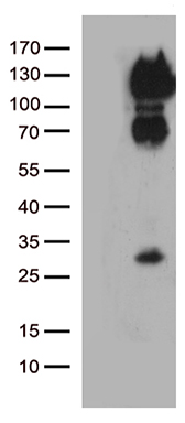 DNAAF11 antibody