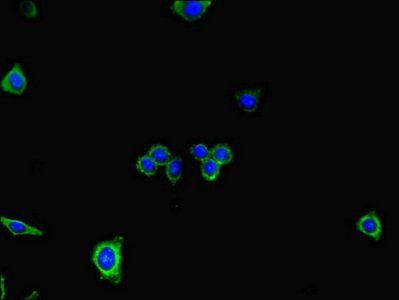 DNAH7 Antibody