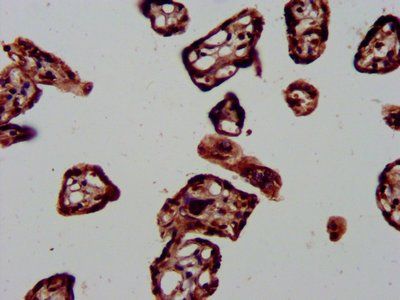 DNAJA1 Antibody