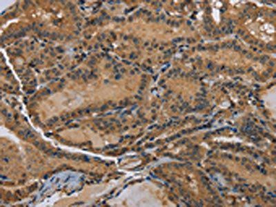 DNAJA1 Antibody