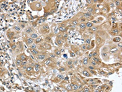 DNAJA3 Antibody