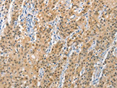 DNAJB1 antibody