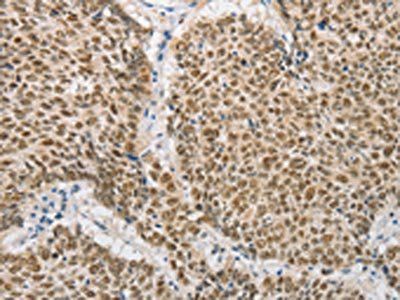 DNAJB1 Antibody