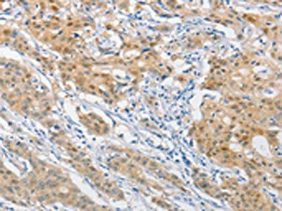 DNAJB1 Antibody