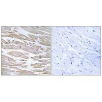 DNAJB11 antibody