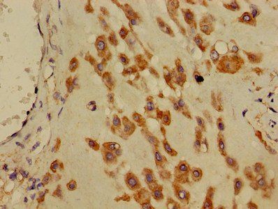 DNAJB11 Antibody