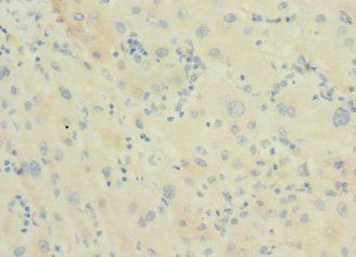 DNAJB14 antibody