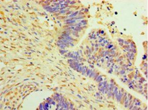 DNAJB2 Antibody