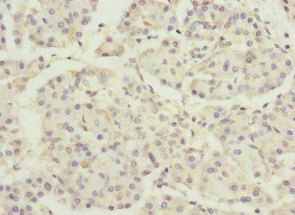 DNAJB2 Antibody