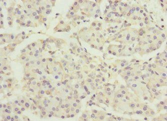 DNAJB2 antibody