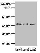 DNAJB2 antibody