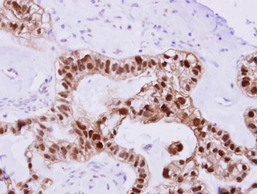 DNAJB2 antibody