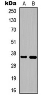 DNAJB2 antibody