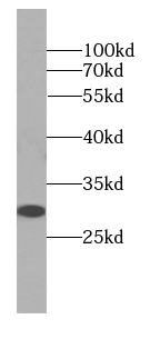 DNAJB3 antibody