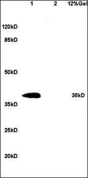 DNAJB4 antibody