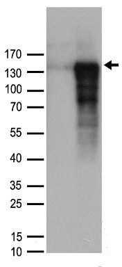 DNAJB6 antibody