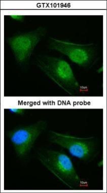 DnaJ heat shock protein family (Hsp40) member B6 Antibody