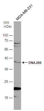 DNAJB6 Rabbit Polyclonal Antibody