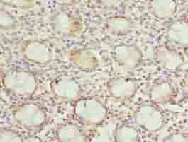 DNAJB8 Antibody