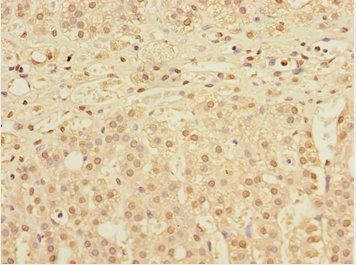 DNAJB9 antibody