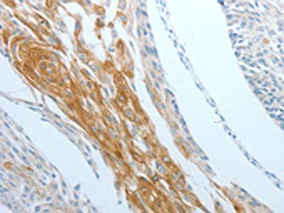 DNAJC10 antibody