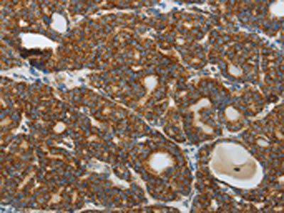 DNAJC10 Antibody