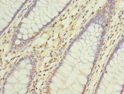 DNAJC17 Antibody