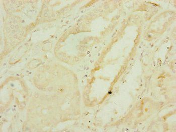 DNAJC19 Antibody