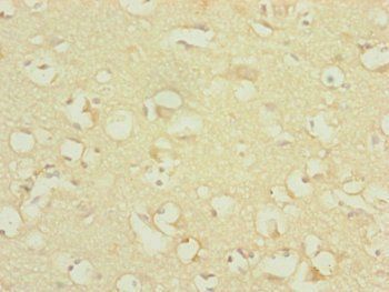 DNAJC19 Antibody