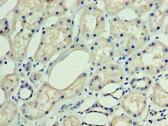 DNAJC30 Antibody