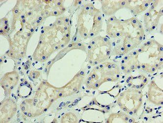 DNAJC30 antibody