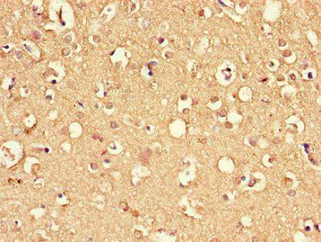 DNAJC6 Antibody