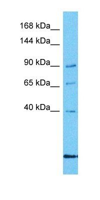 DNAJC6 antibody