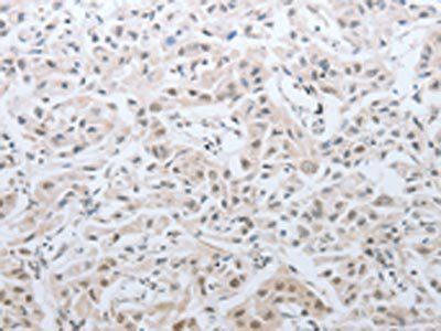 DNAJC7 Antibody