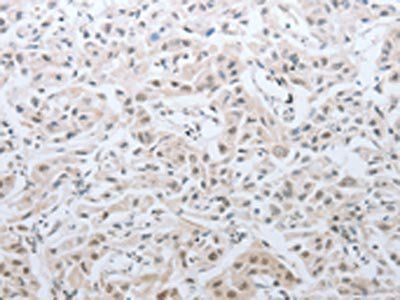 DNAJC7 antibody